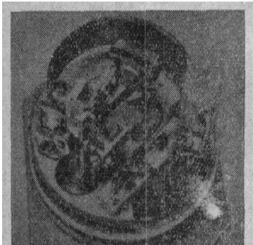 微型組件式壓力變送器的結(jié)構(gòu)圖